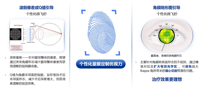 郑州普瑞丨量眼定制独一无二的清晰，个性化近视手术，为您提供极致的视觉体验！(图2)