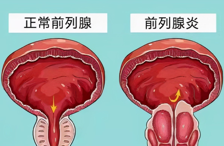 赣州现代泌尿专科医院好不好？专业医疗，呵护您的健康